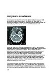 Research Papers 'Galvas smadzeņu traumas', 16.