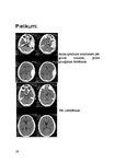 Research Papers 'Galvas smadzeņu traumas', 28.