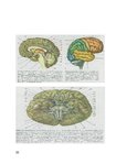 Research Papers 'Galvas smadzeņu traumas', 30.