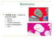 Presentations 'Barotrauma', 13.