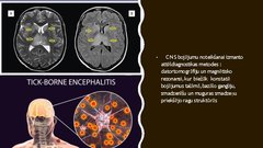 Presentations 'Ērču encefalīta diagnostikas principi', 9.