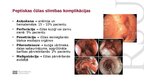 Presentations 'Peptiska čūla', 5.