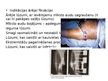 Presentations 'Kustību un balsta aparāta traumu konservatīvās un ķirurģiskās ārstēšanas metodes', 29.