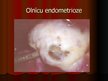 Presentations 'Endometrioze', 11.
