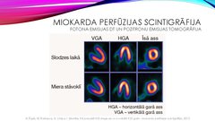 Presentations 'Stabilas koronāro artēriju slimības diagnostika', 26.