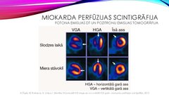 Presentations 'Stabilas koronāro artēriju slimības diagnostika', 27.