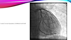 Presentations 'Stabilas koronāro artēriju slimības diagnostika', 36.