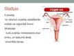 Presentations 'Dzemdes ķermeņa jeb endometrija vēzis', 10.