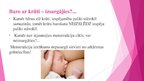 Presentations 'Kontracepcija pēcdzemdību periodā', 3.