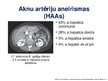 Presentations 'Viscerālo artēriju aneirismas', 6.