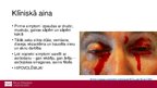 Presentations 'Ebolas vīrusslimība jeb Ebolas hemorāģiskais drudzis', 10.