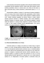 Term Papers 'Lielmolekulārā un mazmolekulārā fluoresceīna pielietojamības salīdzinājums optom', 16.