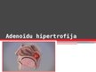 Presentations 'Adenoīdu hipertrofija', 1.
