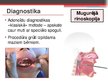 Presentations 'Adenoīdu hipertrofija', 15.