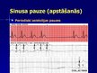 Presentations 'EKG pamati, dzīvībai bīstamie ritmi', 19.