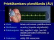 Presentations 'EKG pamati, dzīvībai bīstamie ritmi', 38.