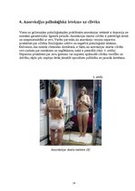 Research Papers 'Anoreksija', 11.