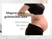 Presentations 'Muguras sāpes grūtniecības laikā un pēcdzemdību periodā', 1.