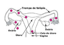 Summaries, Notes 'Ektopiskas grūtniecības anatomiska lokalizācija', 3.