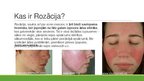 Presentations 'Zīmola "Rosacea Care" ieviešana Latvijas tirgū', 3.