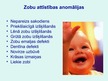Presentations 'Zobu šķilšanās kārtība, likums un patoloģiskas izmaiņas', 15.