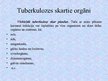 Presentations 'Tuberkuloze', 4.