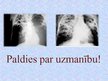 Presentations 'Tuberkuloze', 20.