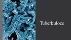 Presentations 'Tuberkuloze', 1.