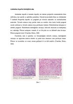Research Papers 'Autoimūns hepatīts', 14.