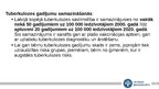 Presentations 'Infekcijas slimība- tuberkuloze', 21.