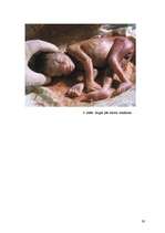 Research Papers 'Aborts, aborta veidi, neauglība, aborta sekas', 26.