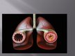 Presentations 'Astma', 7.