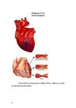 Research Papers 'Koronārās sirds slimības un to riska faktori', 32.