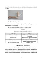 Research Papers 'Roku protēzes', 12.