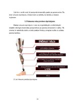 Research Papers 'Roku protēzes', 15.