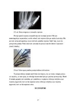 Research Papers 'Roku protēzes', 18.