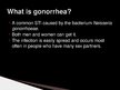 Presentations 'Gonorrhea', 3.