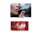 Research Papers 'Smēķēšana un veselība', 34.