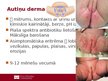 Presentations 'Lokālas infekcijas neonatālā periodā', 2.