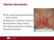 Presentations 'Lokālas infekcijas neonatālā periodā', 3.