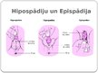 Presentations 'Hipospādija un epispādija', 24.