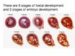 Presentations 'Foetal Development', 3.